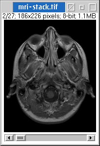 ImageJ MRI Stack